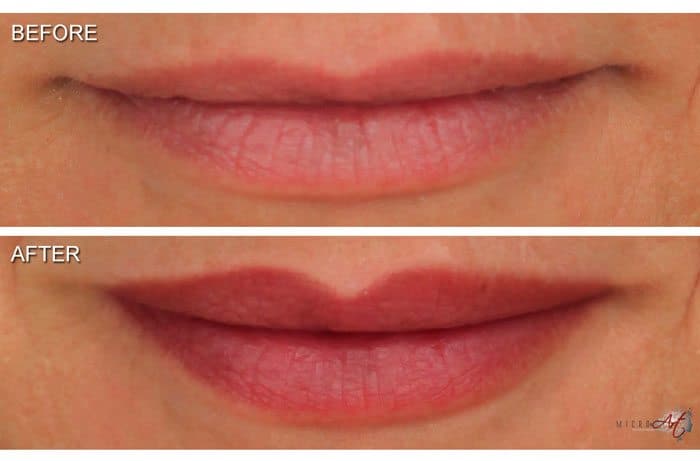 Tattoo Lips Alternative by MicroArt Semi Permanent Makeup