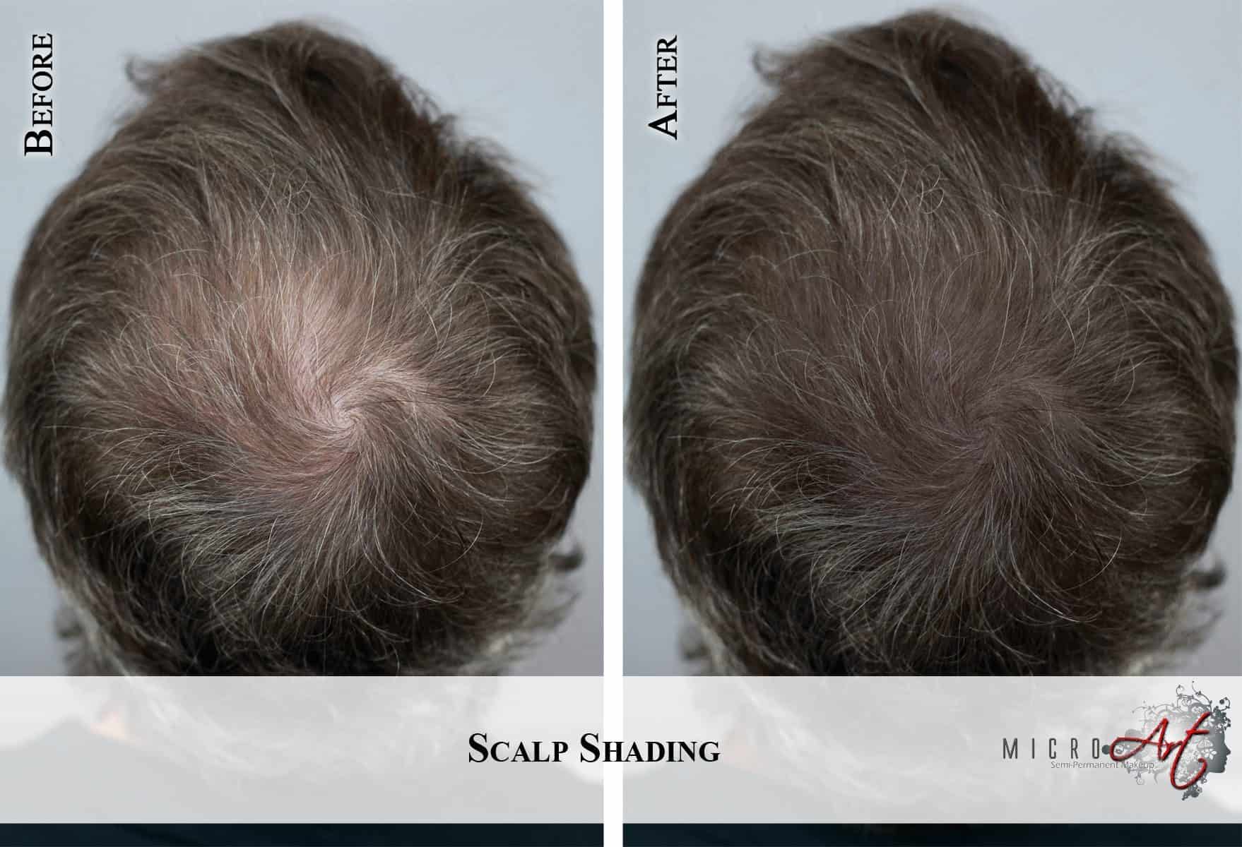 Thinning Hair Solution MicroArt Semi Permanent Makeup